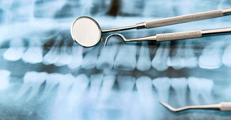 x-ray with teeth-cleaning utensils